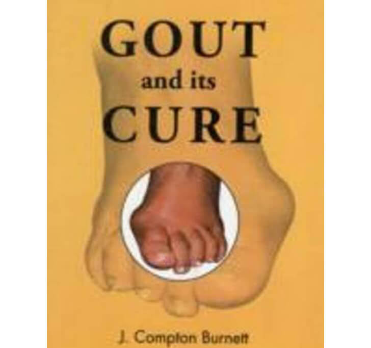 Buy Gout And Its Cure